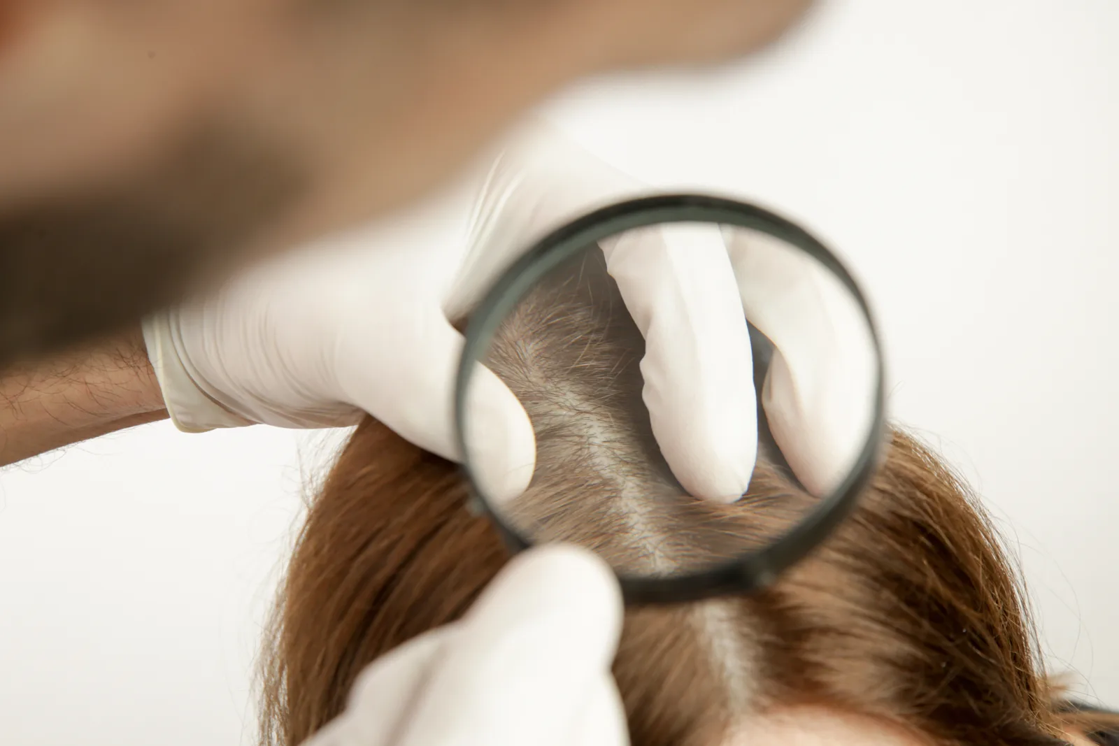 A close view of healthy hair and scalp